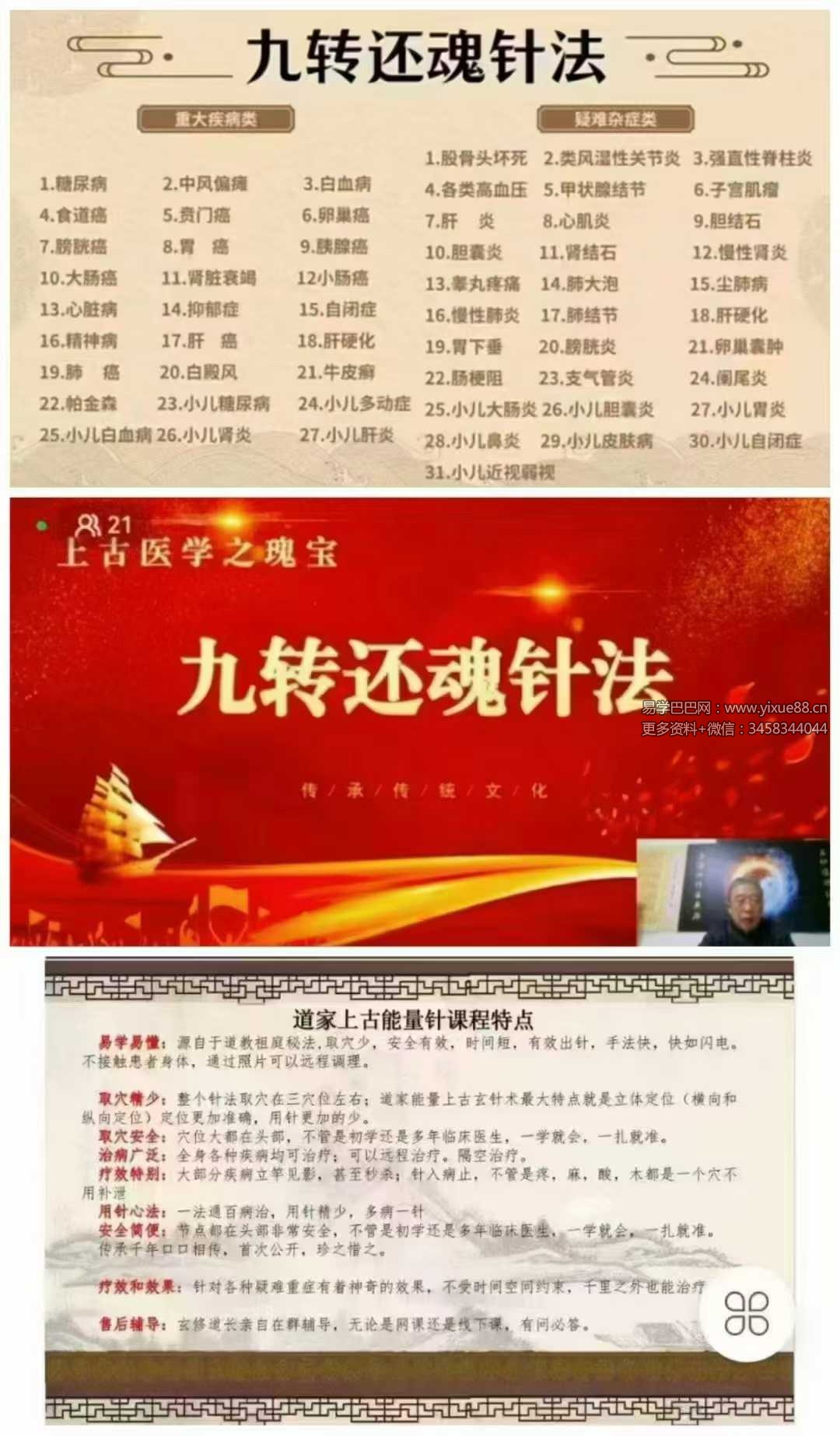 王通福上古医学九转还魂针法1集